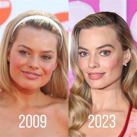 margot robbie before and after surgery|Margot Robbie Before and After Plastic Surgery